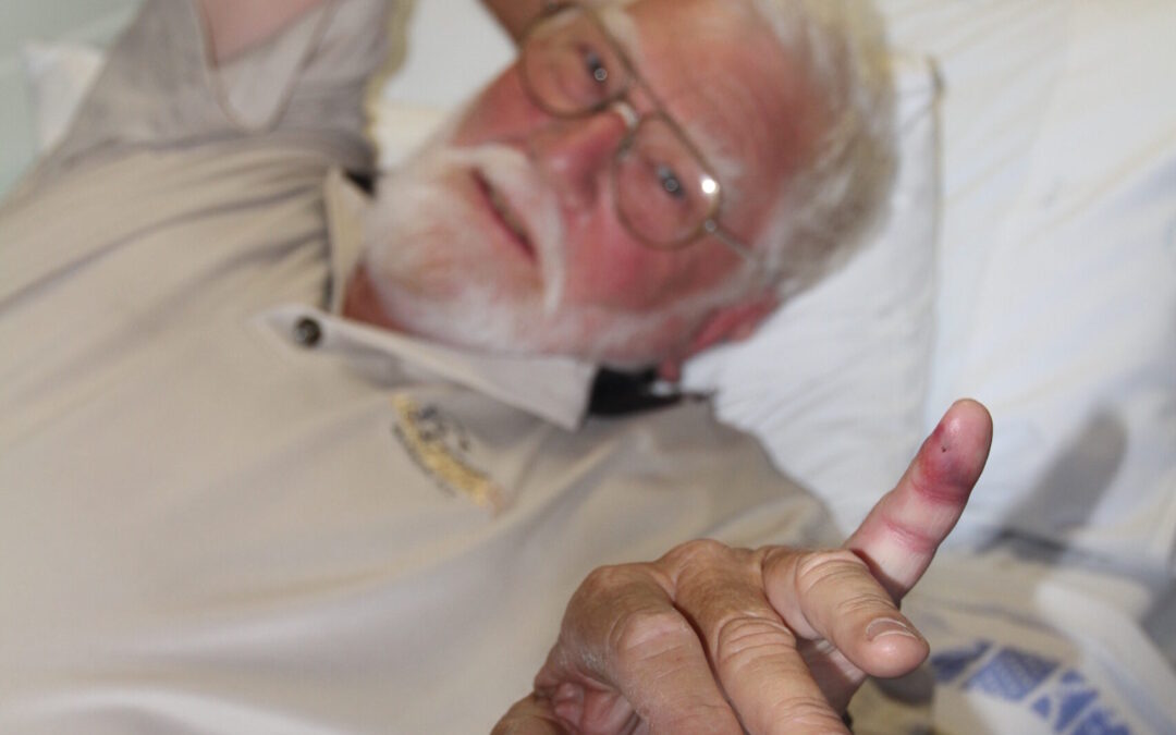 Be cautious with snakes’, reminds snake catcher