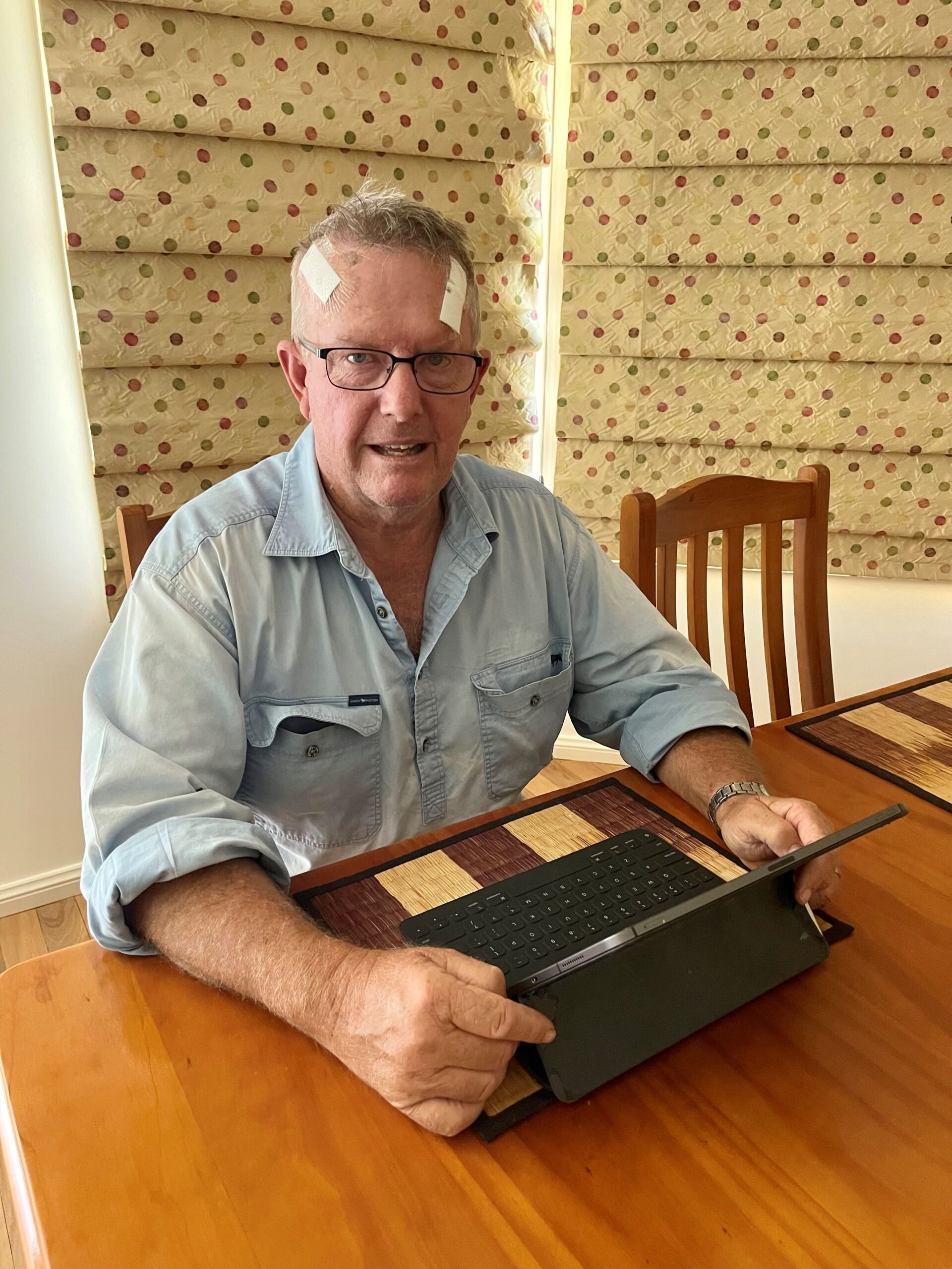 Annual melanoma check could save your life: MP